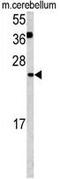 Glutaredoxin 2 antibody, GTX81538, GeneTex, Western Blot image 