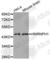 Heterogeneous Nuclear Ribonucleoprotein H1 antibody, A5924, ABclonal Technology, Western Blot image 