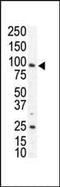 AXL Receptor Tyrosine Kinase antibody, PA5-14566, Invitrogen Antibodies, Western Blot image 