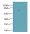 Centrosomal Protein 76 antibody, A58530-100, Epigentek, Western Blot image 