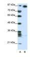 Myoneurin antibody, orb324458, Biorbyt, Western Blot image 