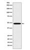 Renin antibody, M03689-1, Boster Biological Technology, Western Blot image 