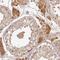 T-cell leukemia/lymphoma protein 1B antibody, NBP2-47608, Novus Biologicals, Immunohistochemistry paraffin image 