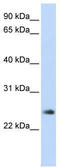 Thymocyte Nuclear Protein 1 antibody, TA334501, Origene, Western Blot image 
