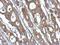 ISG15 Ubiquitin Like Modifier antibody, NBP2-16995, Novus Biologicals, Immunohistochemistry paraffin image 