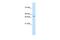 Transcription Factor B2, Mitochondrial antibody, PA5-40897, Invitrogen Antibodies, Western Blot image 