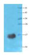 Retinoic Acid Receptor Responder 2 antibody, orb156351, Biorbyt, Western Blot image 