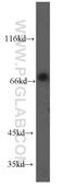 Origin Recognition Complex Subunit 2 antibody, 12739-1-AP, Proteintech Group, Western Blot image 