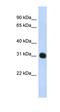 Proteasome Activator Subunit 3 antibody, orb330469, Biorbyt, Western Blot image 