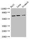 Forkhead Box N1 antibody, CSB-PA008829LA01HU, Cusabio, Western Blot image 