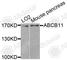 ATP Binding Cassette Subfamily B Member 11 antibody, A8467, ABclonal Technology, Western Blot image 