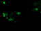 SSX Family Member 1 antibody, LS-C172869, Lifespan Biosciences, Immunofluorescence image 