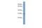 CKLF Like MARVEL Transmembrane Domain Containing 2 antibody, GTX47785, GeneTex, Western Blot image 