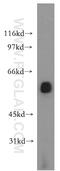 Lecithin-Cholesterol Acyltransferase antibody, 12243-1-AP, Proteintech Group, Western Blot image 