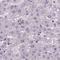 ATPase H+ Transporting V1 Subunit D antibody, NBP2-49254, Novus Biologicals, Immunohistochemistry paraffin image 