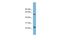 Transmembrane Protein 161A antibody, A12752, Boster Biological Technology, Western Blot image 