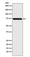 Menin 1 antibody, M00331, Boster Biological Technology, Western Blot image 