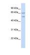 Tweety Family Member 1 antibody, NBP1-59909, Novus Biologicals, Western Blot image 