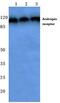 Androgen Receptor antibody, LS-B13271, Lifespan Biosciences, Western Blot image 