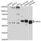 LIM Homeobox Transcription Factor 1 Beta antibody, LS-C749035, Lifespan Biosciences, Western Blot image 