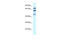 Eukaryotic Translation Initiation Factor 2B Subunit Epsilon antibody, ARP61329_P050, Aviva Systems Biology, Western Blot image 