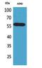 Aldehyde Dehydrogenase 2 Family Member antibody, STJ96720, St John