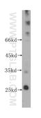 Tetraspanin 3 antibody, 60049-1-Ig, Proteintech Group, Western Blot image 