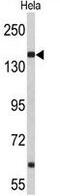 Nucleoporin 153 antibody, GTX80552, GeneTex, Western Blot image 