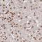 Death Inducer-Obliterator 1 antibody, HPA049904, Atlas Antibodies, Immunohistochemistry frozen image 