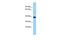 IST1 Factor Associated With ESCRT-III antibody, PA5-46025, Invitrogen Antibodies, Western Blot image 