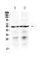 Prostaglandin E Receptor 4 antibody, A02153-2, Boster Biological Technology, Western Blot image 