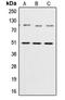 Nuclear Factor Kappa B Subunit 1 antibody, MBS821663, MyBioSource, Western Blot image 