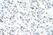 Matrin 3 antibody, A02931, Boster Biological Technology, Immunohistochemistry paraffin image 