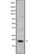 Ribonuclease P/MRP Subunit P25 Like antibody, abx148767, Abbexa, Western Blot image 