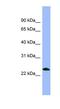 Prepronociceptin antibody, NBP1-59307, Novus Biologicals, Western Blot image 