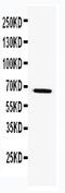TNF Receptor Associated Factor 5 antibody, PA2154, Boster Biological Technology, Western Blot image 
