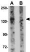 Platelet Endothelial Aggregation Receptor 1 antibody, GTX85138, GeneTex, Western Blot image 