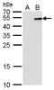 Interferon Lambda 3 antibody, GTX629760, GeneTex, Western Blot image 