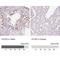 Synaptonemal Complex Central Element Protein 2 antibody, NBP1-90637, Novus Biologicals, Immunohistochemistry paraffin image 