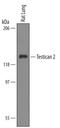 SPARC (Osteonectin), Cwcv And Kazal Like Domains Proteoglycan 2 antibody, PA5-48009, Invitrogen Antibodies, Western Blot image 