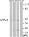 G Protein-Coupled Receptor 34 antibody, GTX87375, GeneTex, Western Blot image 