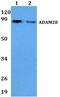 ADAM Metallopeptidase Domain 28 antibody, PA5-75835, Invitrogen Antibodies, Western Blot image 