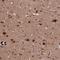 Solute Carrier Family 11 Member 2 antibody, NBP1-91841, Novus Biologicals, Immunohistochemistry paraffin image 