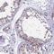 Treacher Collins syndrome protein antibody, NBP1-86908, Novus Biologicals, Immunohistochemistry paraffin image 