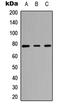 TNNI3 Interacting Kinase antibody, LS-C358369, Lifespan Biosciences, Western Blot image 