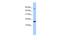 Lysozyme-like protein 6 antibody, PA5-44117, Invitrogen Antibodies, Western Blot image 