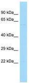 PAT1 Homolog 2 antibody, TA334346, Origene, Western Blot image 