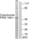 Cytochrome P450 Family 19 Subfamily A Member 1 antibody, LS-C119485, Lifespan Biosciences, Western Blot image 