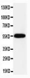 Caspase 8 antibody, LS-C312687, Lifespan Biosciences, Western Blot image 