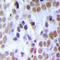 Minichromosome Maintenance Complex Component 3 antibody, orb378175, Biorbyt, Immunohistochemistry paraffin image 